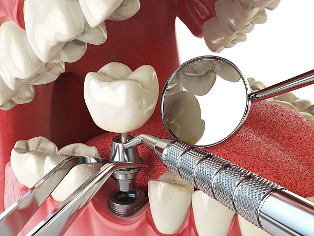 Best Emergency Treatment for Toothache in Cape Charles, VA